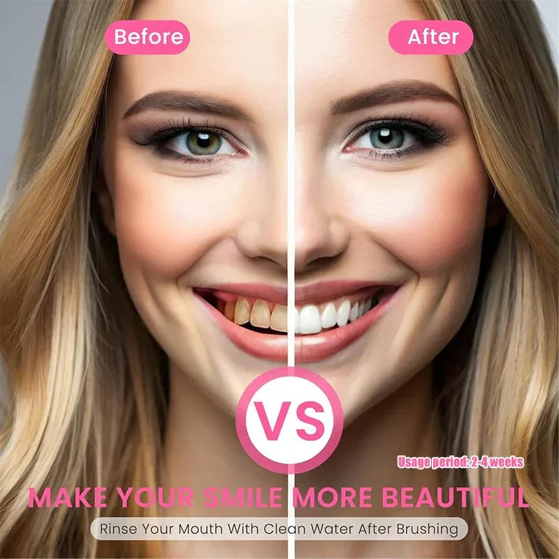 Niacinamide Whitening Toothpaste - For Healthier, Whiter Teeth!