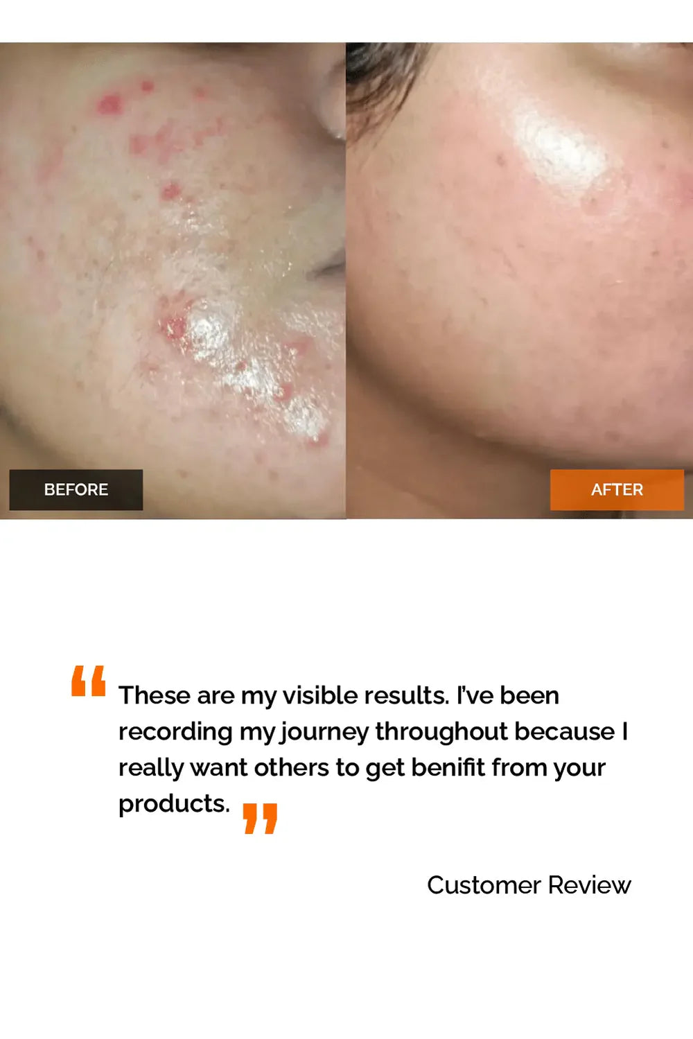 Salicylic Acid 2% Face Wash